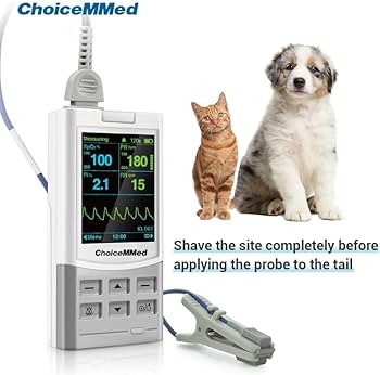 Patient Monitor